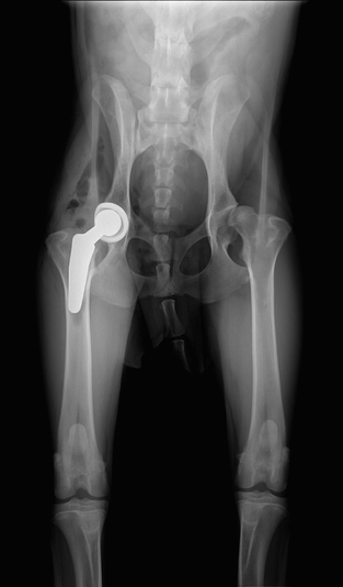 Bild 2: Röntgenbild einer Hüftgelenksendoprothese beim Hund